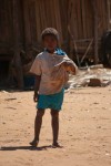 Madagascar : La malnutrition à l’origine de 35% des décès d’enfants de moins de 5 ans 